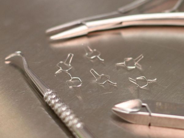 Drahtligaturen zum Festbinden eines Drahtes am Bracket